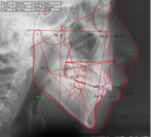 01-Cepha02small.jpgのサムネール画像